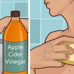 acv-